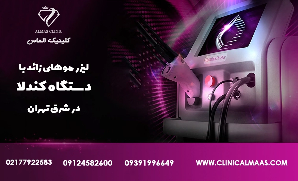 لیزر موهای زائد با دستگاه کندلا در شرق تهران